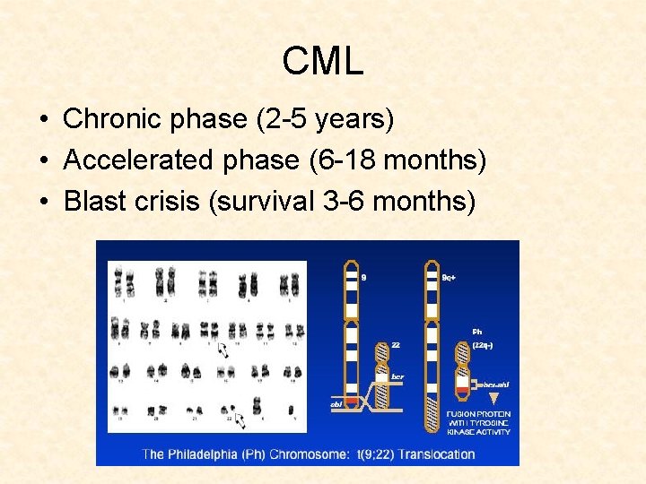 CML • Chronic phase (2 -5 years) • Accelerated phase (6 -18 months) •