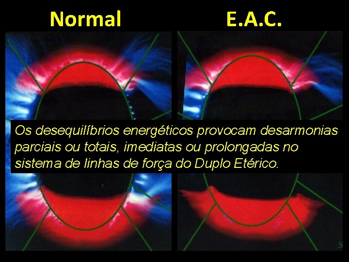 Normal E. A. C. Os desequilíbrios energéticos provocam desarmonias parciais ou totais, imediatas ou