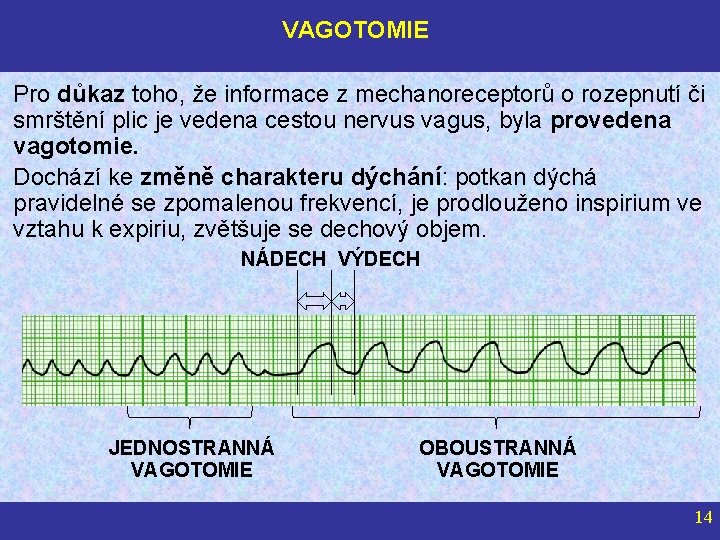 VAGOTOMIE Pro důkaz toho, že informace z mechanoreceptorů o rozepnutí či smrštění plic je