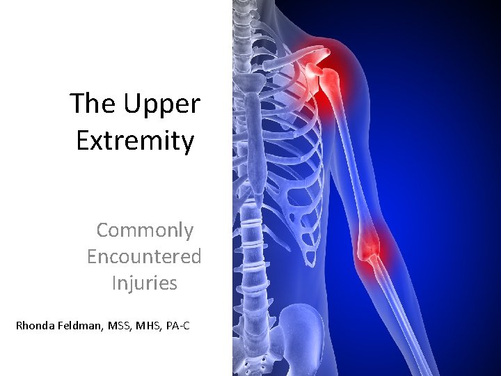 The Upper Extremity Commonly Encountered Injuries Rhonda Feldman, MSS, MHS, PA-C 
