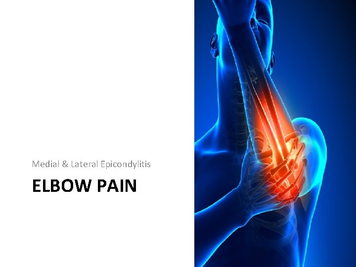 Medial & Lateral Epicondylitis ELBOW PAIN 