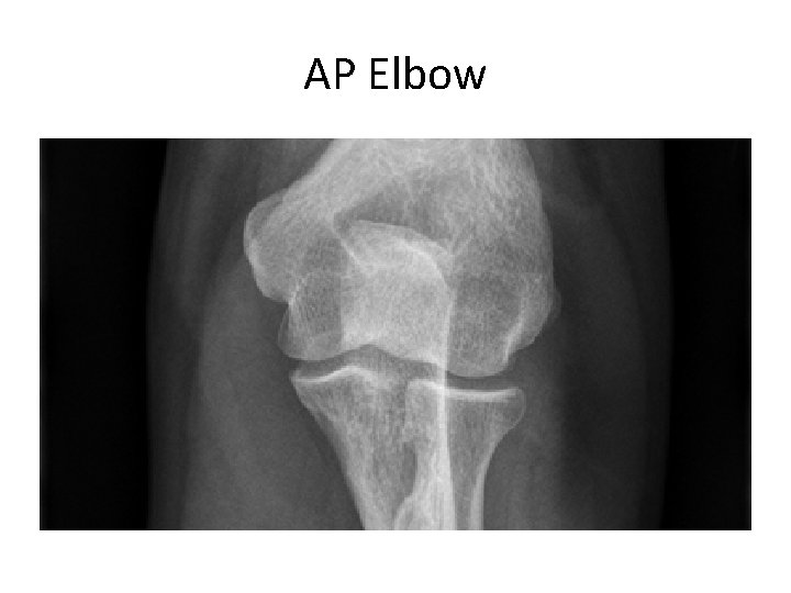 AP Elbow 