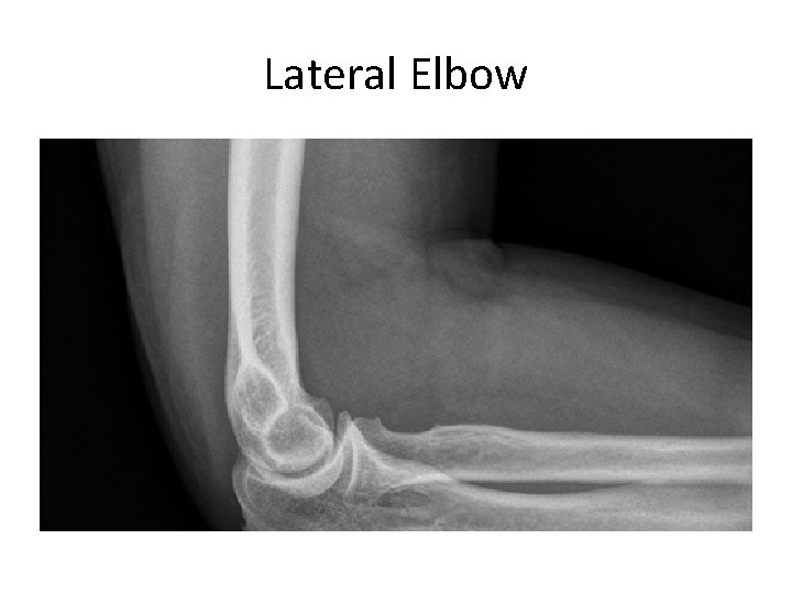 Lateral Elbow 