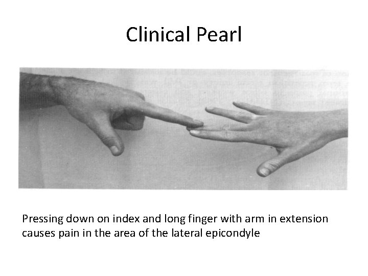 Clinical Pearl Pressing down on index and long finger with arm in extension causes