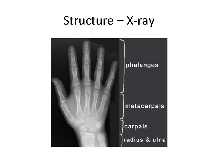 Structure – X-ray 