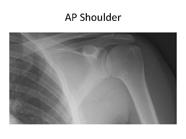 AP Shoulder 