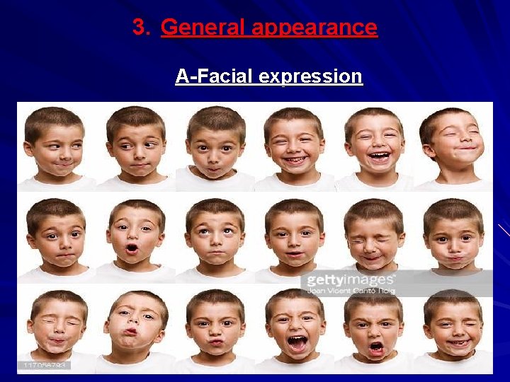 3. General appearance A-Facial expression 
