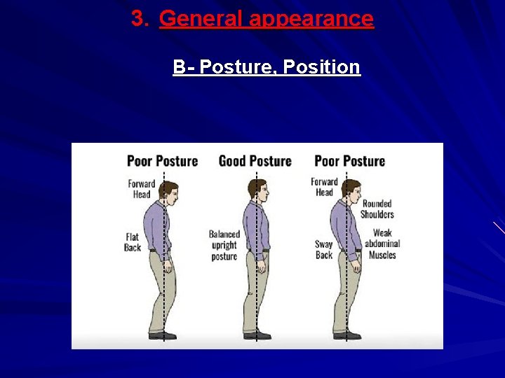 3. General appearance B- Posture, Position 
