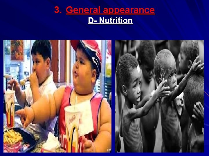 3. General appearance D- Nutrition 