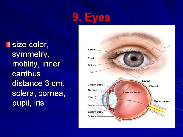 9. Eyes size color, symmetry, motility, inner canthus distance 3 cm. sclera, cornea, pupil,