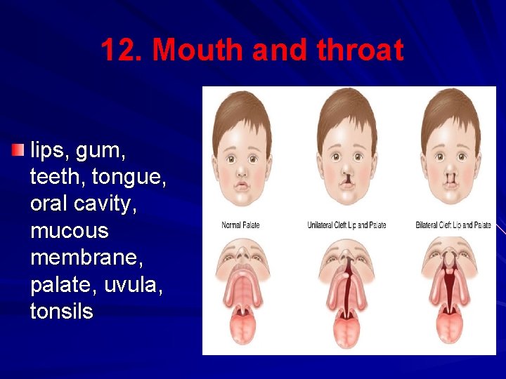 12. Mouth and throat lips, gum, teeth, tongue, oral cavity, mucous membrane, palate, uvula,