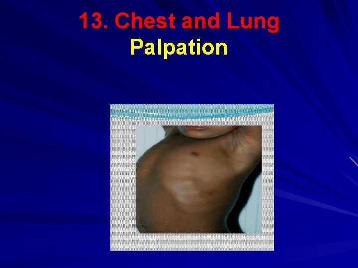 13. Chest and Lung Palpation 