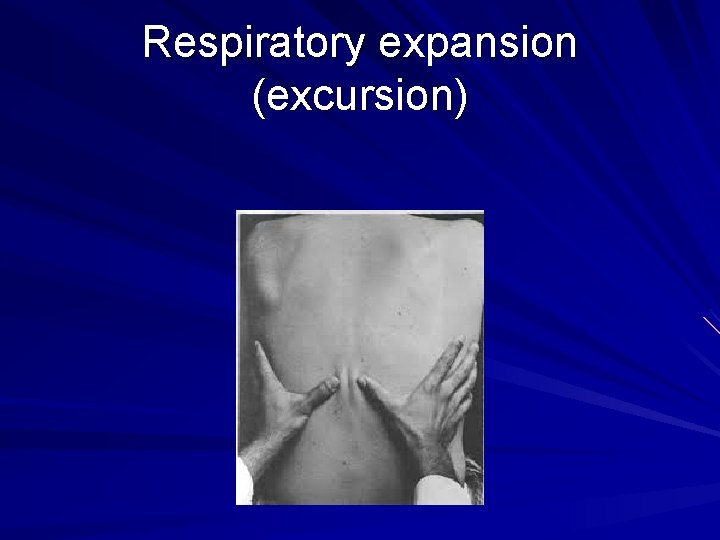 Respiratory expansion (excursion) 