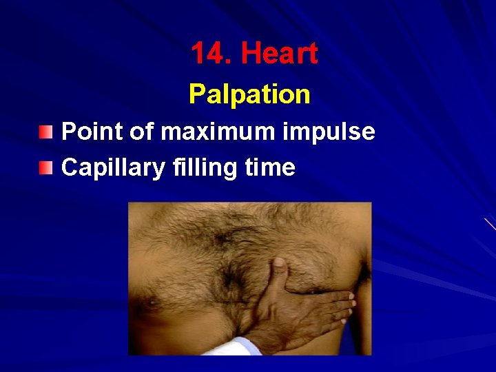 14. Heart Palpation Point of maximum impulse Capillary filling time 