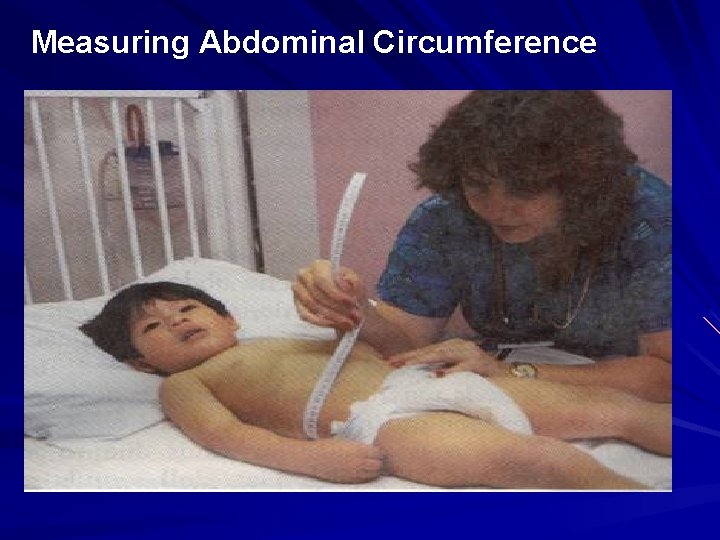 Measuring Abdominal Circumference 