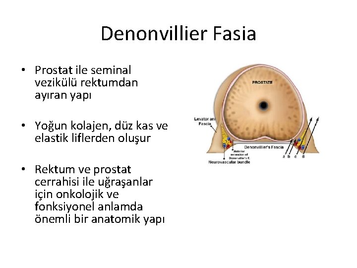 Denonvillier Fasia • Prostat ile seminal vezikülü rektumdan ayıran yapı • Yoğun kolajen, düz