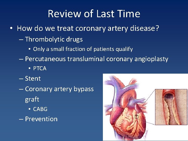 Review of Last Time • How do we treat coronary artery disease? – Thrombolytic