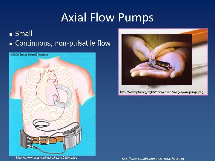 Axial Flow Pumps n n Small Continuous, non-pulsatile flow http: //www. pbs. org/wgbh/nova/eheart/images/axialpump. jpeg