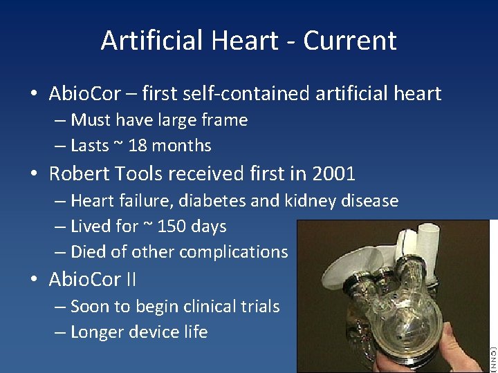 Artificial Heart - Current • Abio. Cor – first self-contained artificial heart – Must