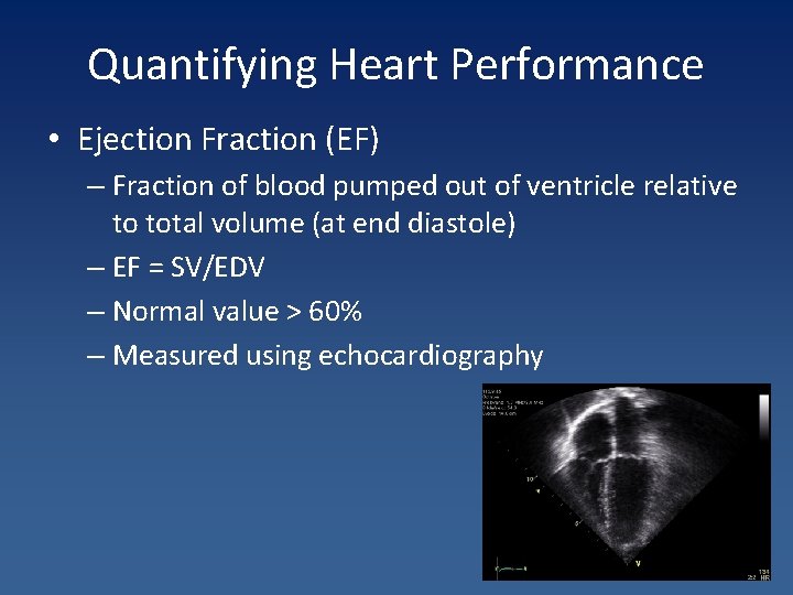Quantifying Heart Performance • Ejection Fraction (EF) – Fraction of blood pumped out of