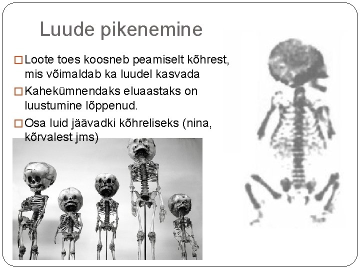 Luude pikenemine � Loote toes koosneb peamiselt kõhrest, mis võimaldab ka luudel kasvada � Luude pikenemine � Loote toes koosneb peamiselt kõhrest, mis võimaldab ka luudel kasvada �
