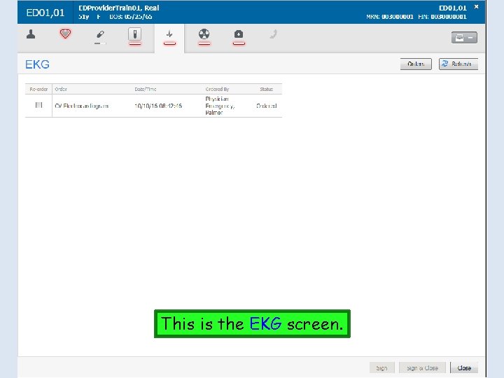 This is the EKG screen. 