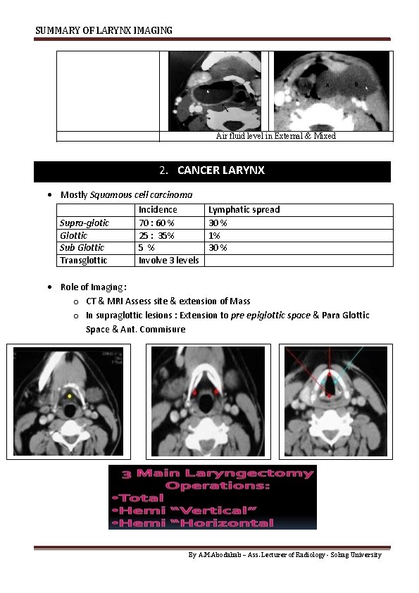 SUMMARY OF LARYNX IMAGING Air fluid level in External & Mixed 2. CANCER LARYNX