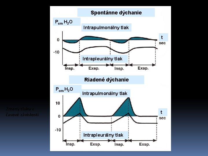 Spontánne dýchanie Pcm H 2 O Intrapulmonálny tlak t Intrapleurálny tlak Riadené dýchanie Pcm