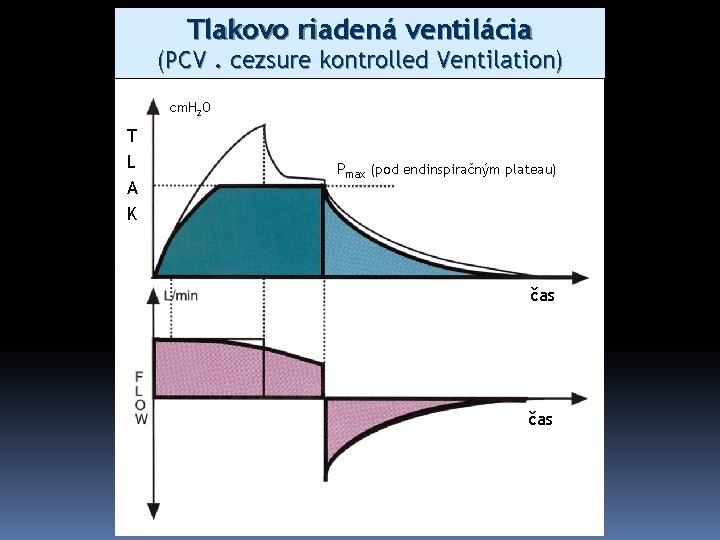 Tlakovo riadená ventilácia (PCV. cezsure kontrolled Ventilation) cm. H 2 O T L A