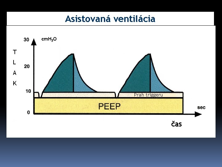 Asistovaná ventilácia cm. H 2 O T L A K Prah triggeru čas 