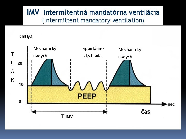 IMV Intermitentná mandatórna ventilácia (Intermittent mandatory ventilation) cm. H 2 O 2 O T