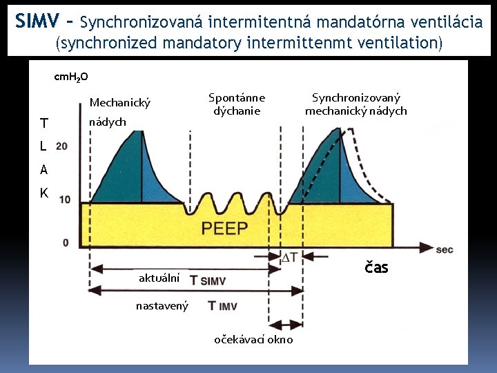 SIMV – Synchronizovaná intermitentná mandatórna ventilácia (synchronized mandatory intermittenmt ventilation) cm. H 2 O