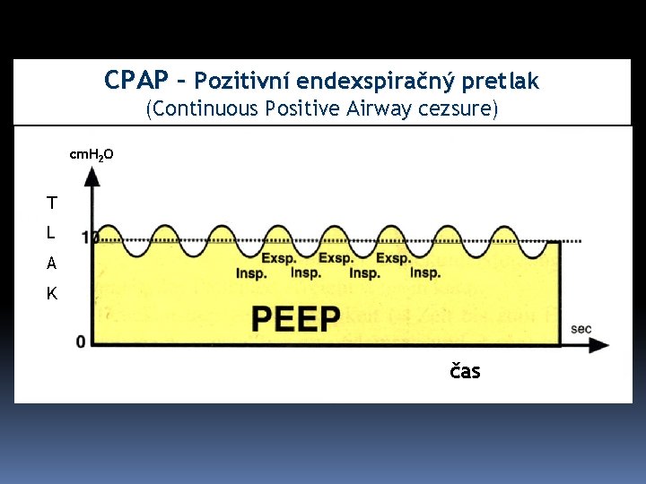 CPAP – Pozitivní endexspiračný pretlak (Continuous Positive Airway cezsure) cm. H 2 O T