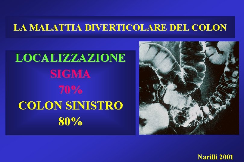 LA MALATTIA DIVERTICOLARE DEL COLON LOCALIZZAZIONE SIGMA 70% COLON SINISTRO 80% FOTO Narilli 2001 LA MALATTIA DIVERTICOLARE DEL COLON LOCALIZZAZIONE SIGMA 70% COLON SINISTRO 80% FOTO Narilli 2001