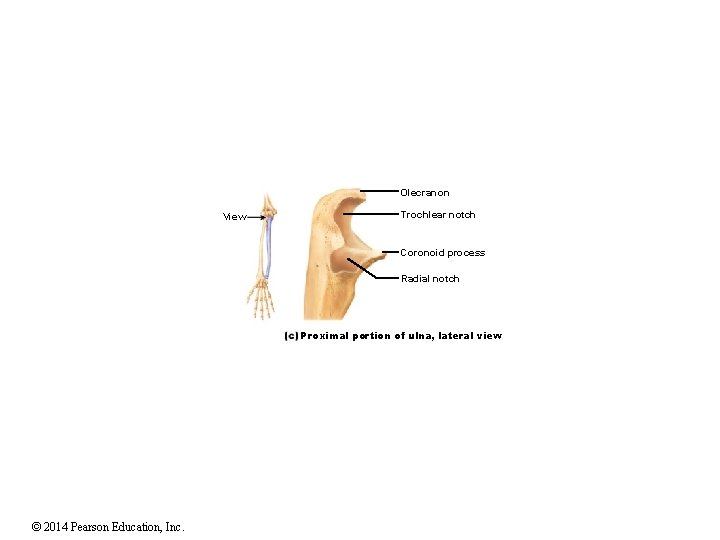 Olecranon View Trochlear notch Coronoid process Radial notch Proximal portion of ulna, lateral view Olecranon View Trochlear notch Coronoid process Radial notch Proximal portion of ulna, lateral view
