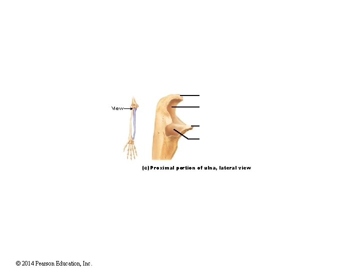 View Proximal portion of ulna, lateral view © 2014 Pearson Education, Inc. View Proximal portion of ulna, lateral view © 2014 Pearson Education, Inc.