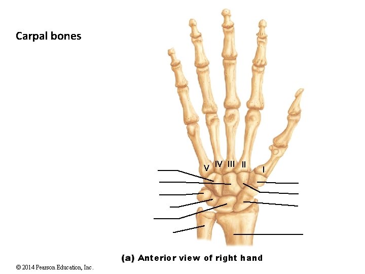 Carpal bones V IV III II I Anterior view of right hand © 2014 Carpal bones V IV III II I Anterior view of right hand © 2014