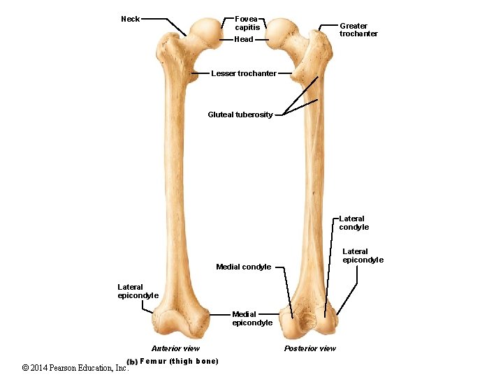 Fovea capitis Neck Greater trochanter Head Lesser trochanter Gluteal tuberosity Lateral condyle Lateral epicondyle Fovea capitis Neck Greater trochanter Head Lesser trochanter Gluteal tuberosity Lateral condyle Lateral epicondyle