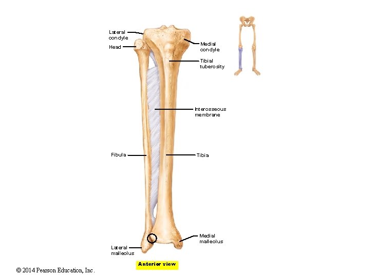 Lateral condyle Medial condyle Head Tibial tuberosity Interosseous membrane Fibula Tibia Medial malleolus Lateral Lateral condyle Medial condyle Head Tibial tuberosity Interosseous membrane Fibula Tibia Medial malleolus Lateral