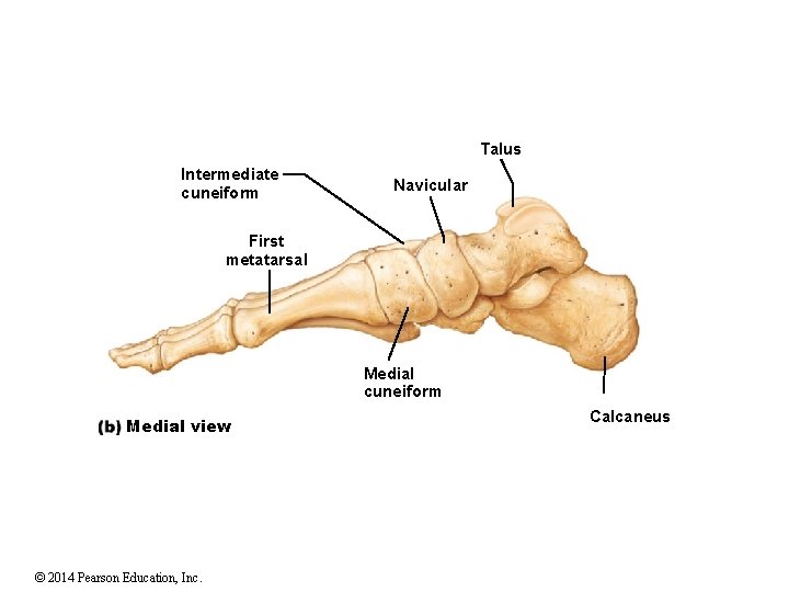 Talus Intermediate cuneiform Navicular First metatarsal Medial cuneiform Medial view © 2014 Pearson Education, Talus Intermediate cuneiform Navicular First metatarsal Medial cuneiform Medial view © 2014 Pearson Education,