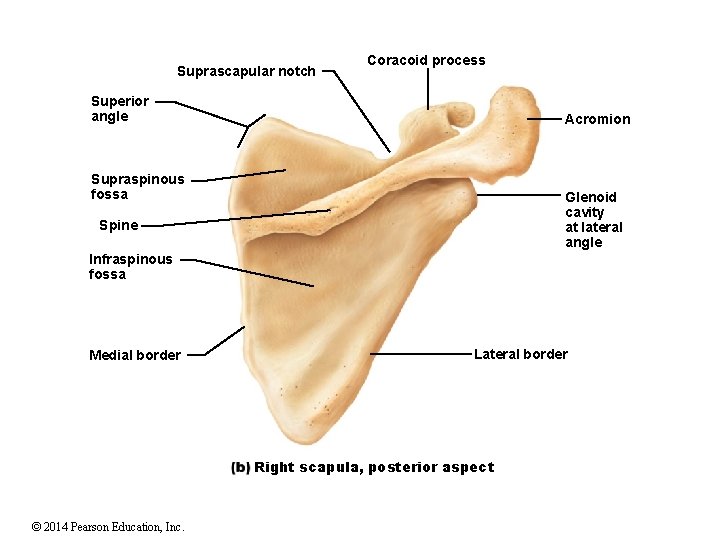 Suprascapular notch Coracoid process Superior angle Acromion Supraspinous fossa Glenoid cavity at lateral angle Suprascapular notch Coracoid process Superior angle Acromion Supraspinous fossa Glenoid cavity at lateral angle
