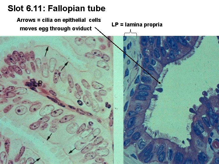 Slot 6. 11: Fallopian tube Arrows = cilia on epithelial cells moves egg through