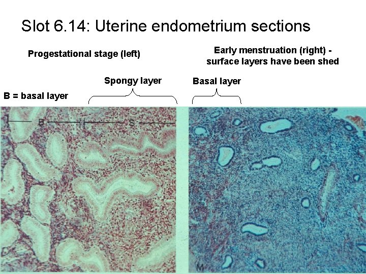 Slot 6. 14: Uterine endometrium sections Progestational stage (left) Spongy layer B = basal