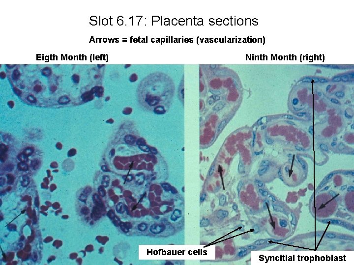 Slot 6. 17: Placenta sections Arrows = fetal capillaries (vascularization) Eigth Month (left) Ninth