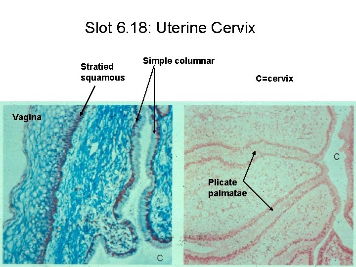 Slot 6. 18: Uterine Cervix Stratied squamous Simple columnar C=cervix Vagina Plicate palmatae 