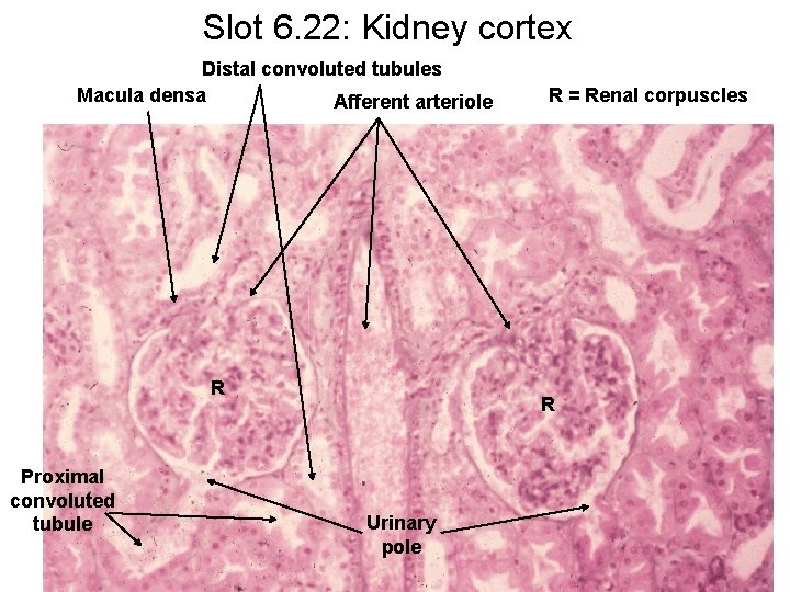 Slot 6. 22: Kidney cortex Distal convoluted tubules Macula densa Afferent arteriole R Proximal