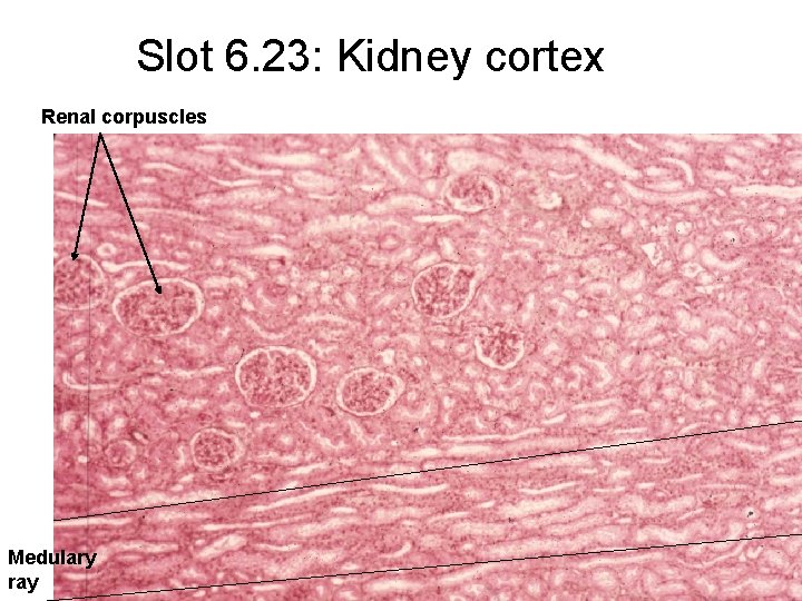 Slot 6. 23: Kidney cortex Renal corpuscles Medulary ray 