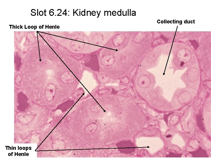 Slot 6. 24: Kidney medulla Thick Loop of Henle Thin loops of Henle Collecting