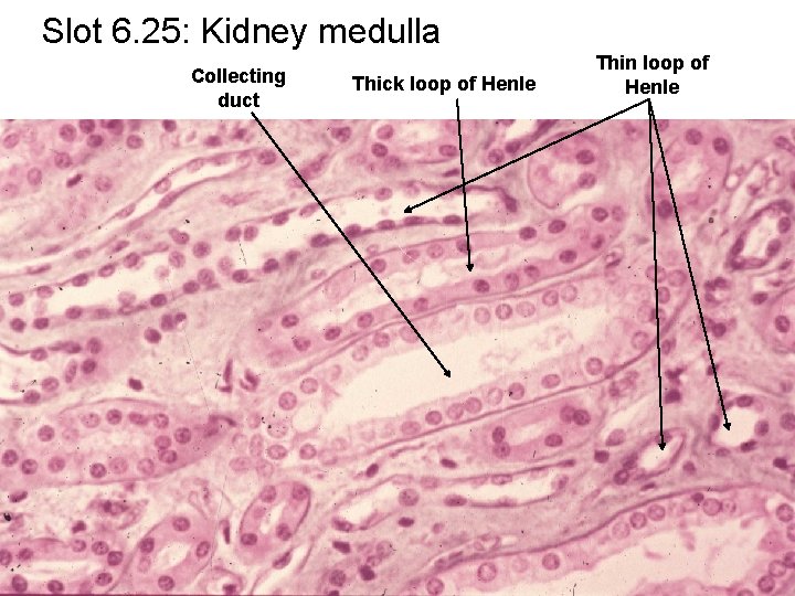 Slot 6. 25: Kidney medulla Collecting duct Thick loop of Henle Thin loop of