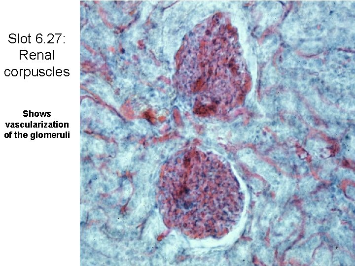 Slot 6. 27: Renal corpuscles Shows vascularization of the glomeruli 